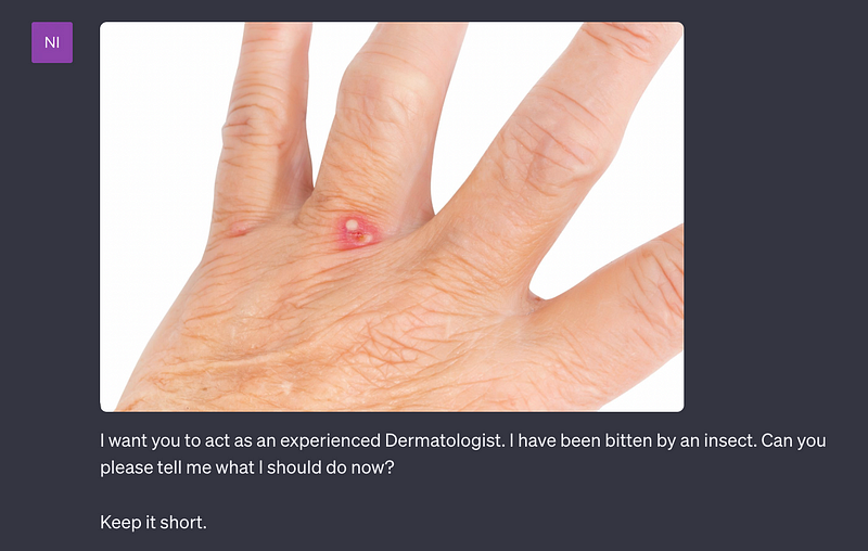 Image of an insect bite for health advice.