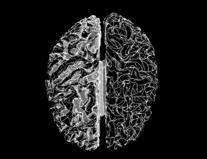 Visual representation of brain structure